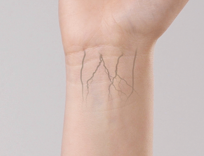 Wrists with different colored veins