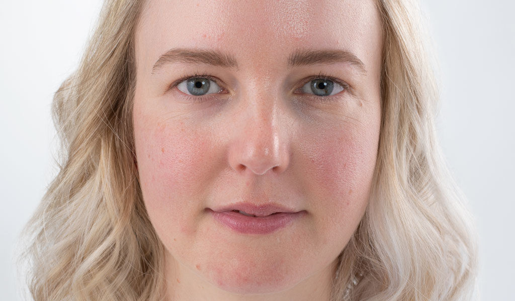 Vorher- und Nachher-Effekt beim Schminktipp Make-up bei Hautproblemen