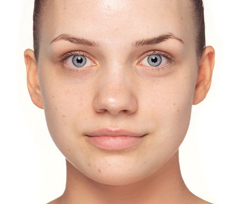 Prima e dopo l'effetto del Make-up Tip Blemished Skin